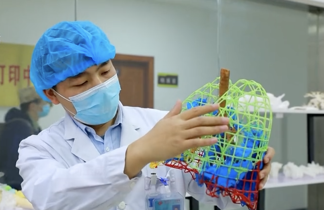 【视频】3D打印的新冠肺炎病灶模型长啥样？