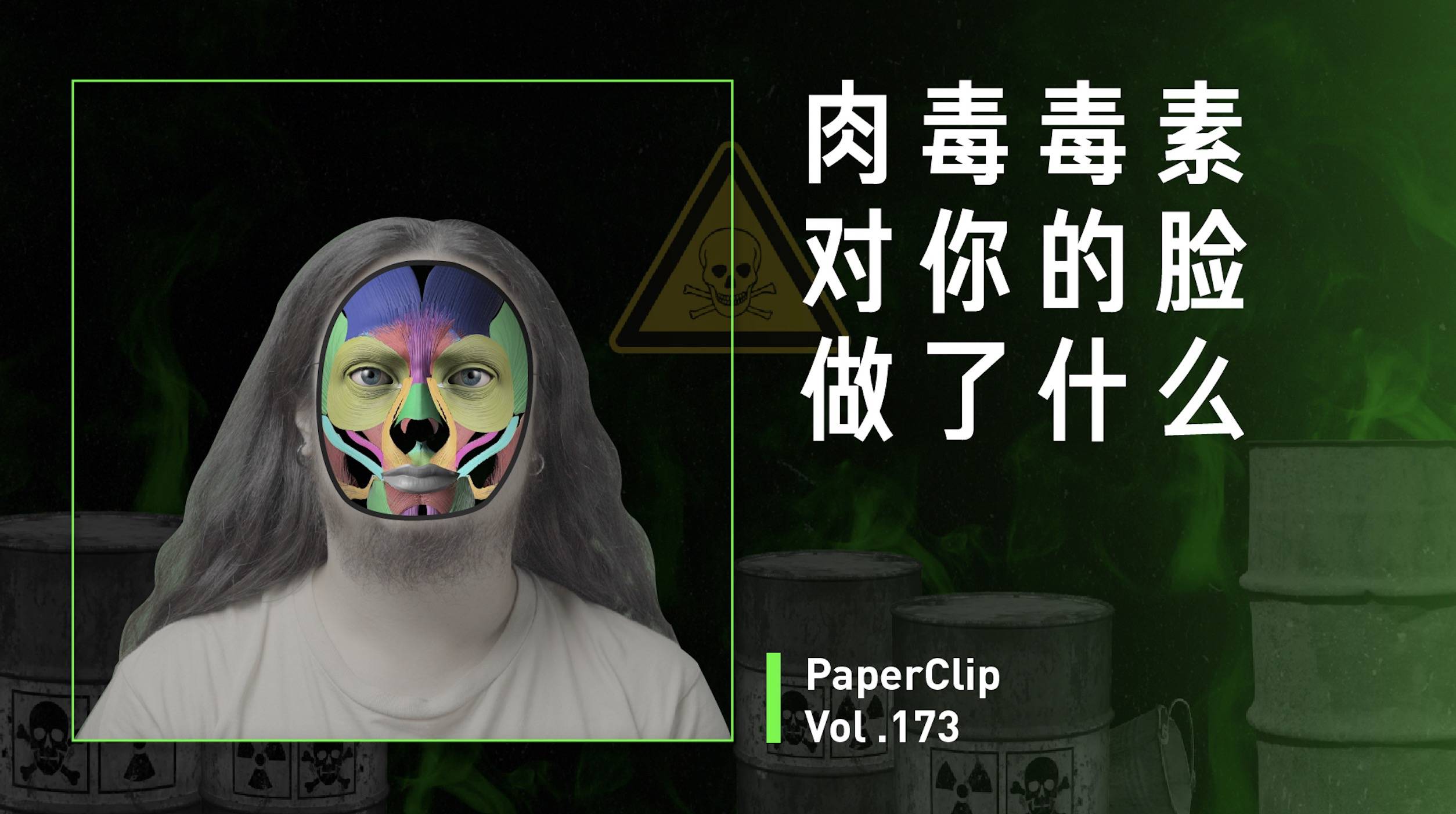 【回形针PaperClip】肉毒毒素对你的脸做了什么?