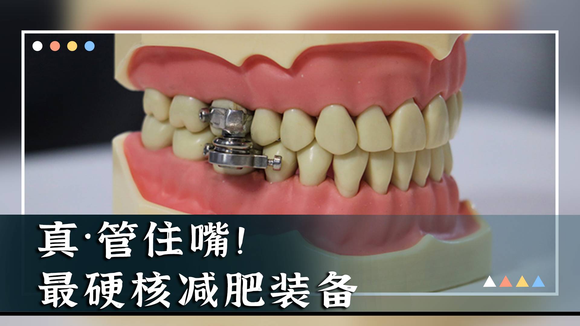 真·管住嘴！最硬核减肥装备！