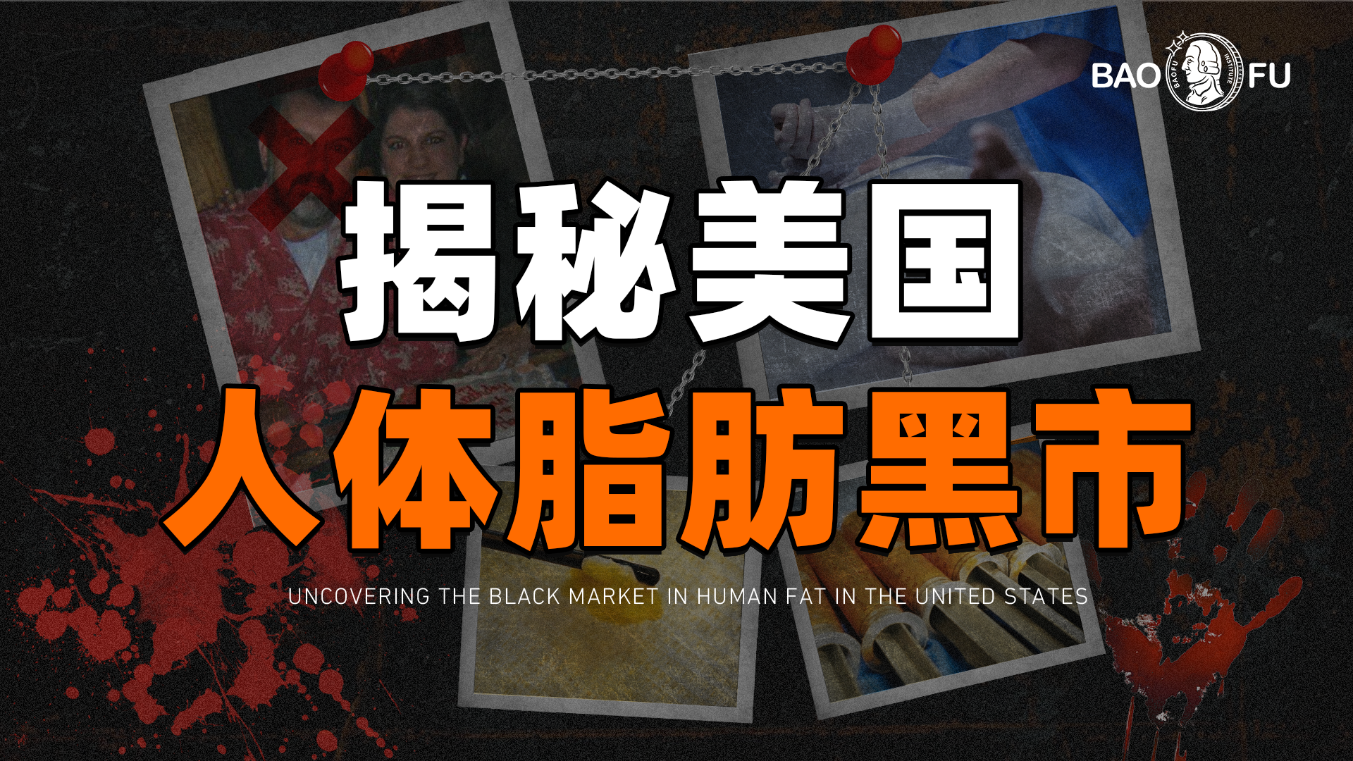 深扒美國“吃人”產(chǎn)業(yè)鏈：遺體脂肪整容，骨粉種牙， 美國醫(yī)美徹底瘋魔！